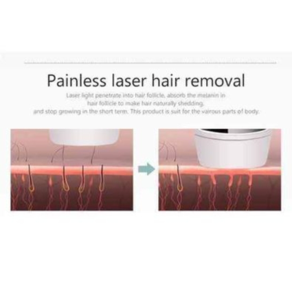 Permanent hair removal IPL laser. Kemei km6812